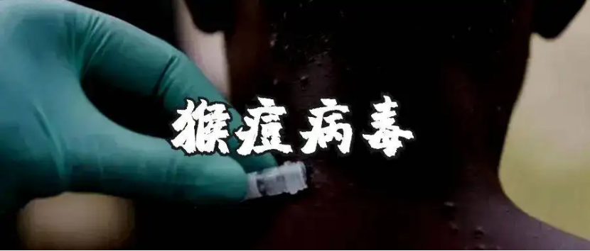羟丙基倍他环糊精用于猴痘病毒